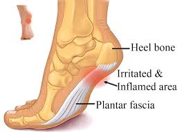 base of foot pain