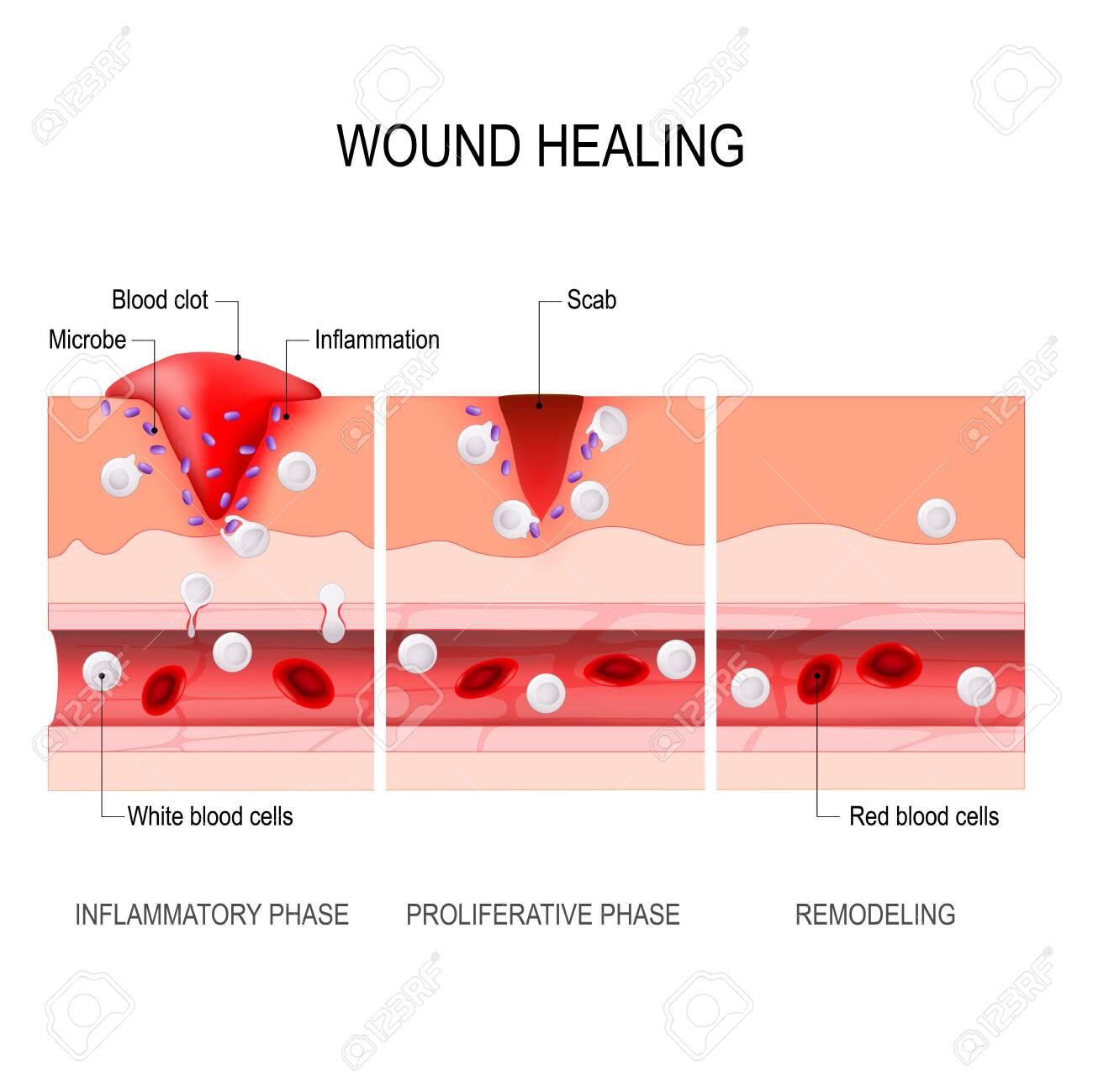 Wound Healing Process - Healers-world.com B04